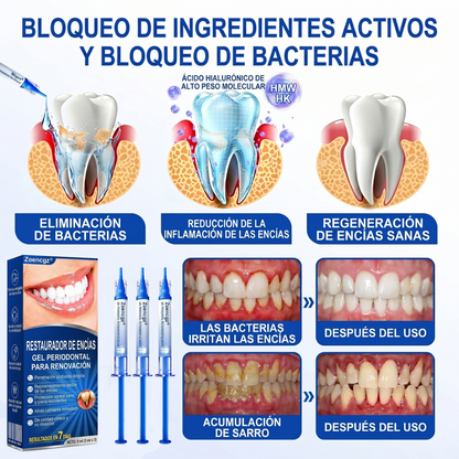 Zoencgz® 🦷🧴 Gel antibacteriano para la regeneración de las encías | Resultados visibles en 7 días