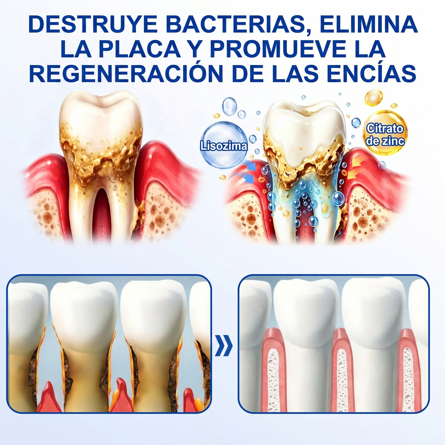 Zoencgz® 🦷🧴 Gel antibacteriano para la regeneración de las encías | Resultados visibles en 7 días