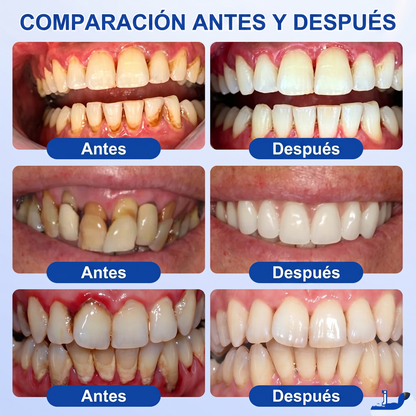 Zoencgz® 🦷🧴 Gel antibacteriano para la regeneración de las encías | Resultados visibles en 7 días